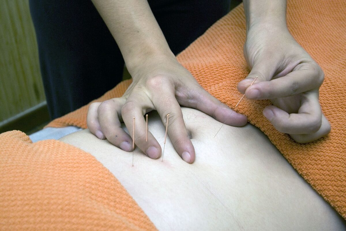 acupuncture, physiotherapy, wellness-4175625.jpg